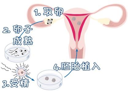 关于找卵代生子机构